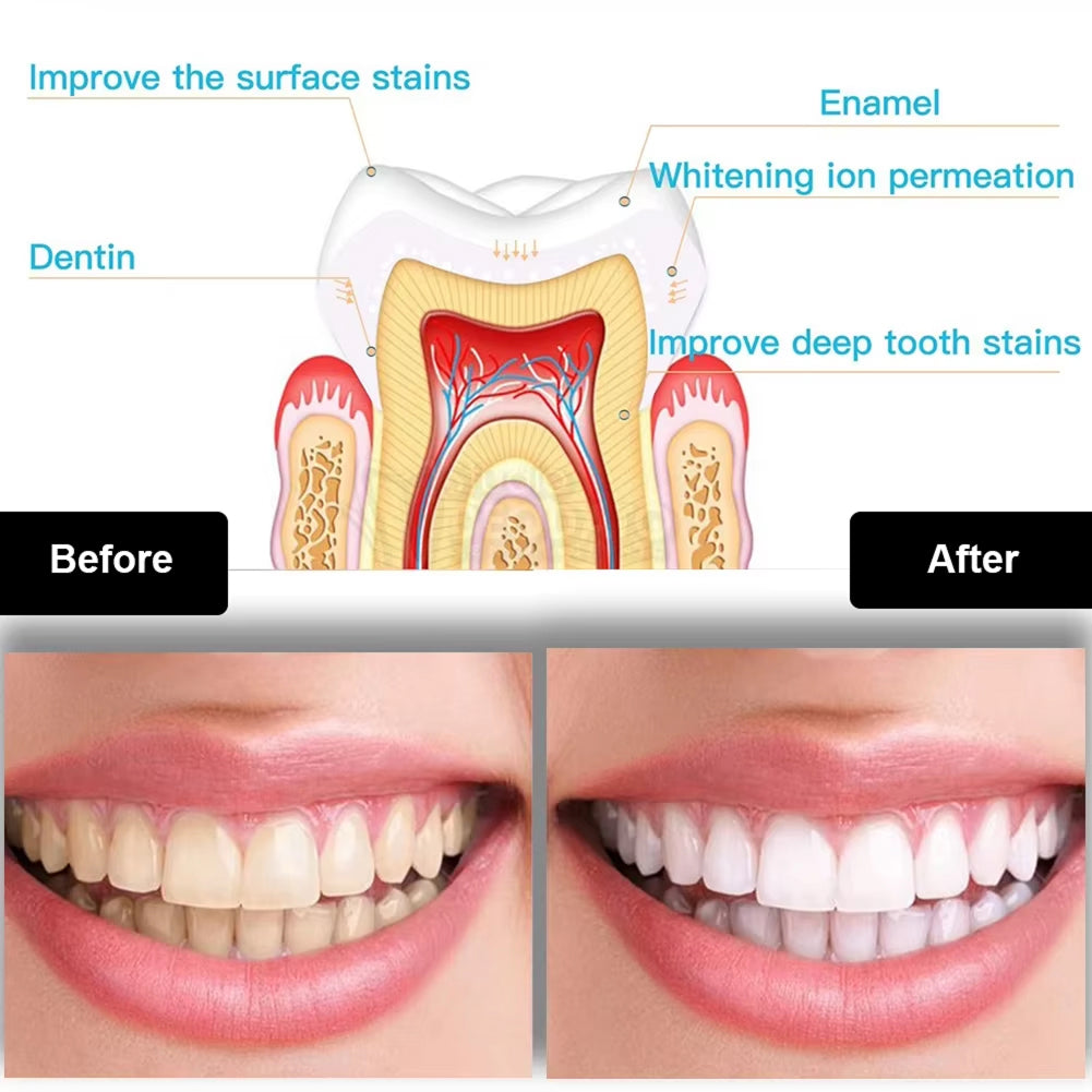 LumiMouni Professional LED Teeth Whitening Kit with 16 High-Power Bulbs, 35% Carbamide Peroxide and Wireless USB Rechargeable Base
