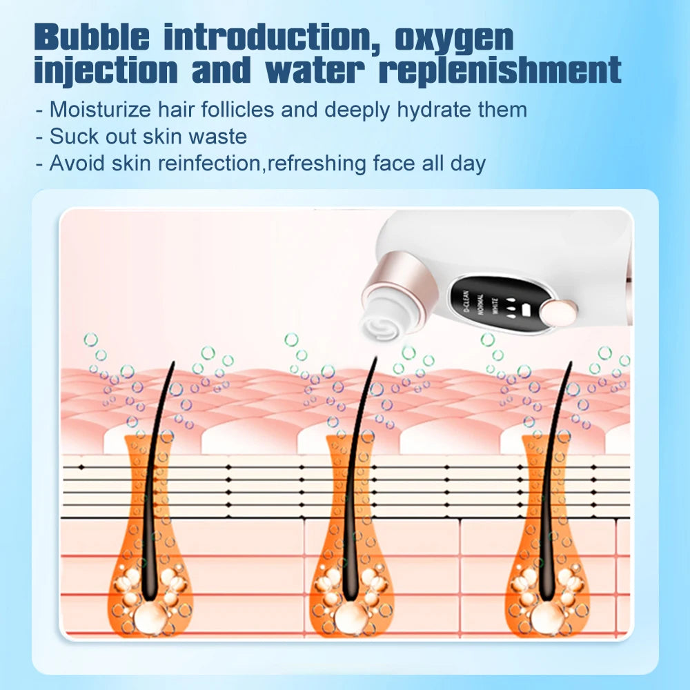 Professional Blackhead Remover Pore Vacuum with Small Bubble Technology