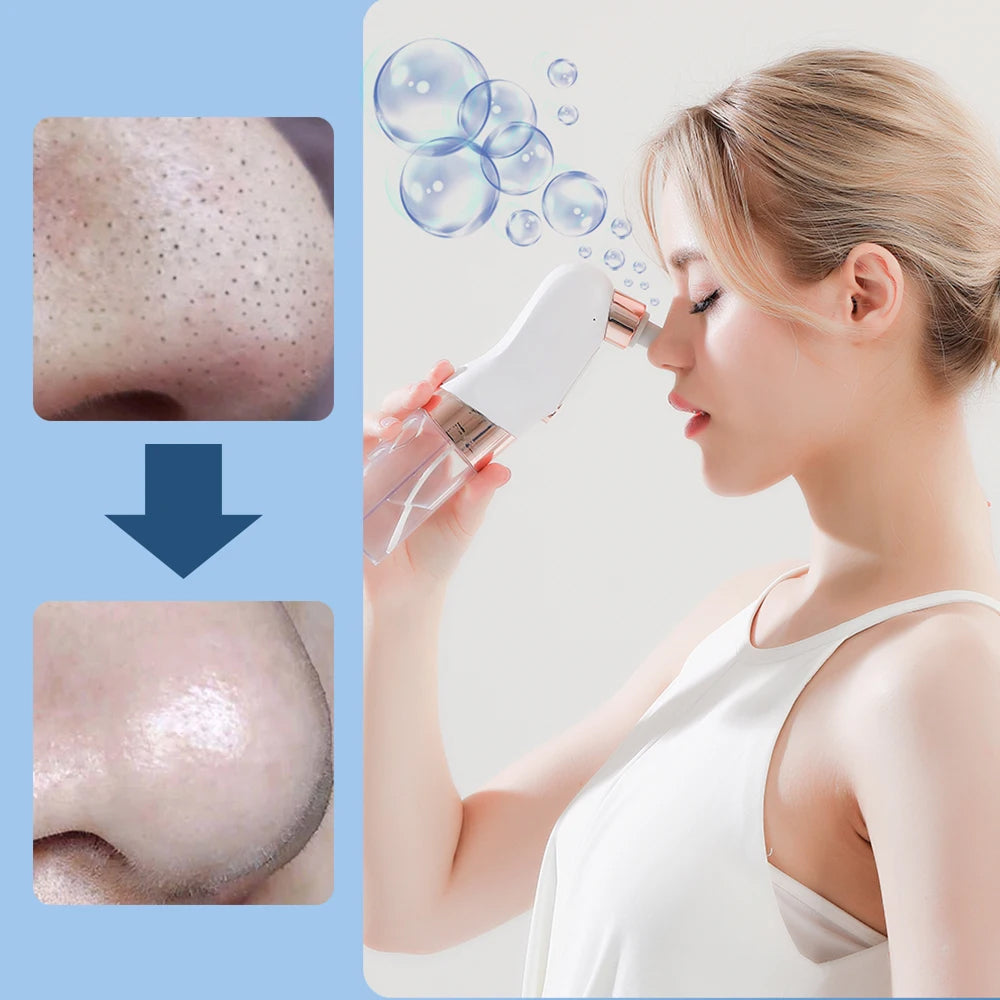 Professional Blackhead Remover Pore Vacuum with Small Bubble Technology