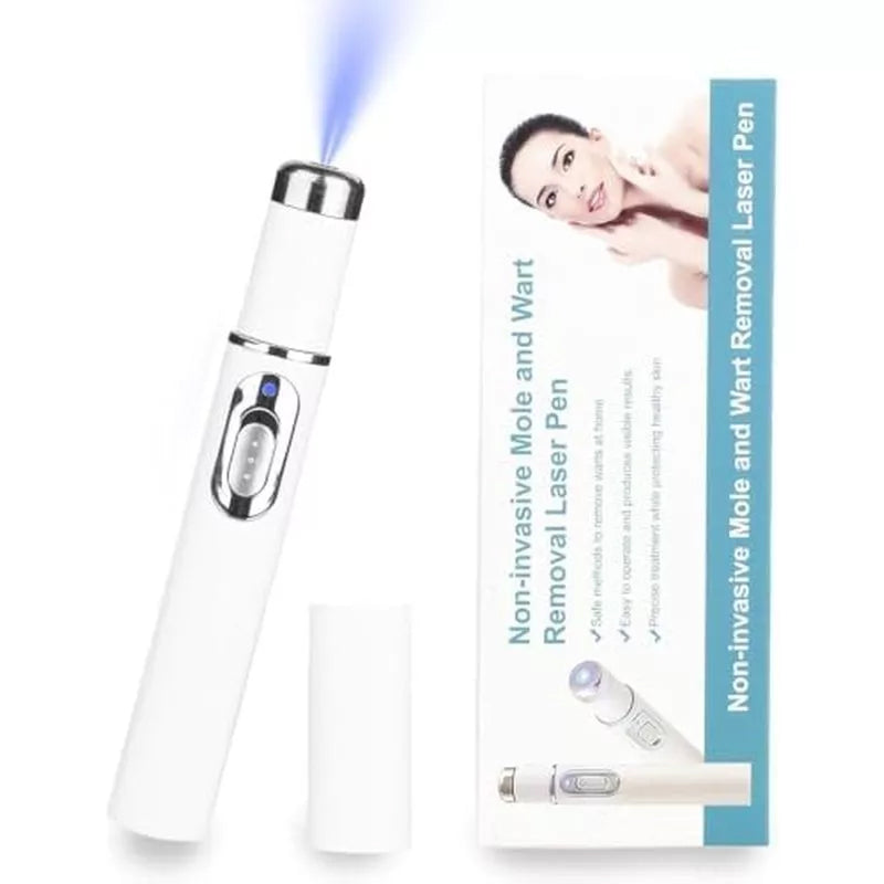 TalfMous Blue LED Light Therapy Wart Treatment