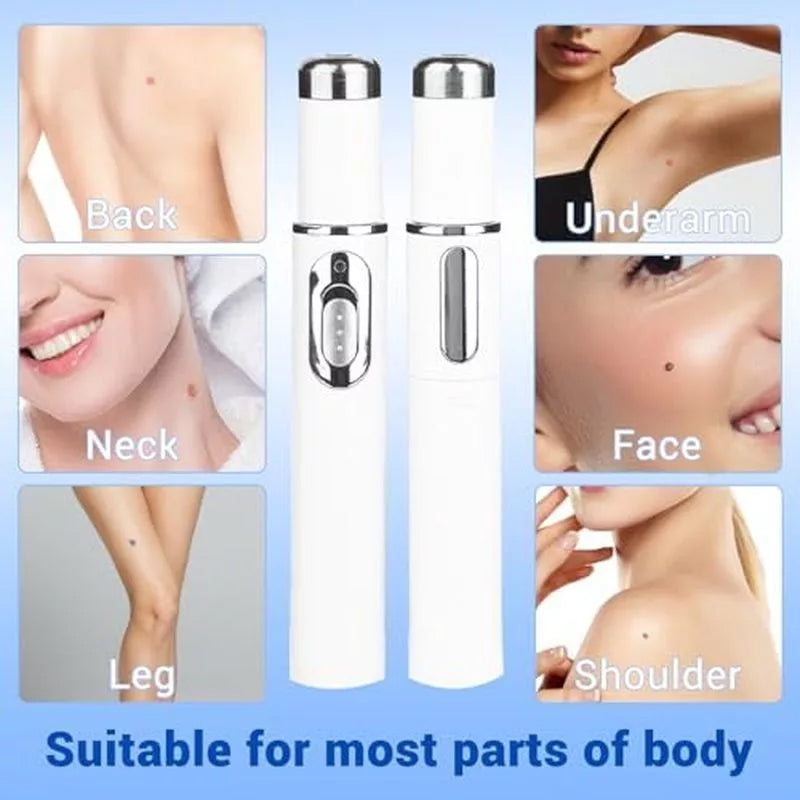 TalfMous Blue LED Light Therapy Wart Treatment