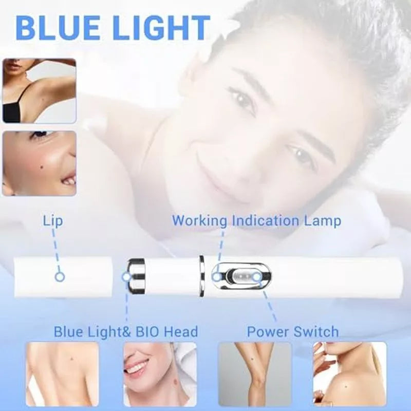 TalfMous Blue LED Light Therapy Wart Treatment