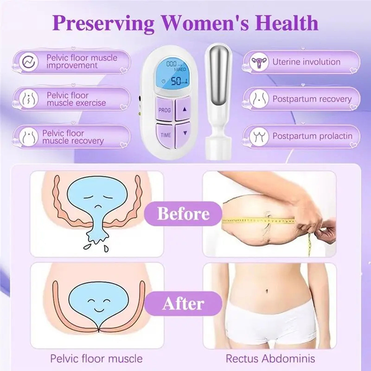 TraciPeliv Electrical Stimulation Device for Urinary Incontinence